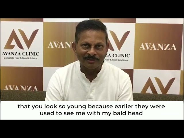 hair transplant youtube video 9